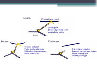 Muscular dystrophy | PPT