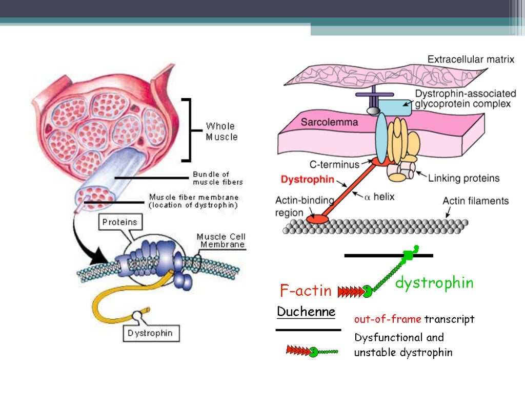 Muscular Dystrophy