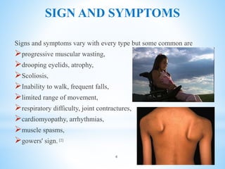 SIGN AND SYMPTOMS
Signs and symptoms vary with every type but some common are
progressive muscular wasting,
drooping eyelids, atrophy,
Scoliosis,
Inability to walk, frequent falls,
limited range of movement,
respiratory difficulty, joint contractures,
cardiomyopathy, arrhythmias,
muscle spasms,
gowers' sign. [2]
4
 