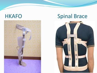 HKAFO Spinal Brace
 .
 