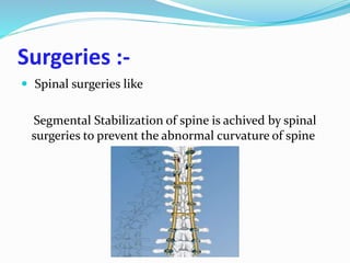 Surgeries :-
 Spinal surgeries like
Segmental Stabilization of spine is achived by spinal
surgeries to prevent the abnormal curvature of spine
 