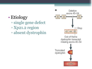 • Etiology
▫ single gene defect
▫ Xp21.2 region
▫ absent dystrophin
 