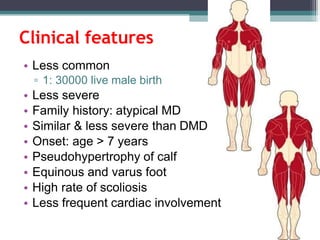 • Less common
▫ 1: 30000 live male birth
• Less severe
• Family history: atypical MD
• Similar & less severe than DMD
• Onset: age > 7 years
• Pseudohypertrophy of calf
• Equinous and varus foot
• High rate of scoliosis
• Less frequent cardiac involvement
Clinical features
 