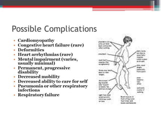 muscular dystrophy.pptx