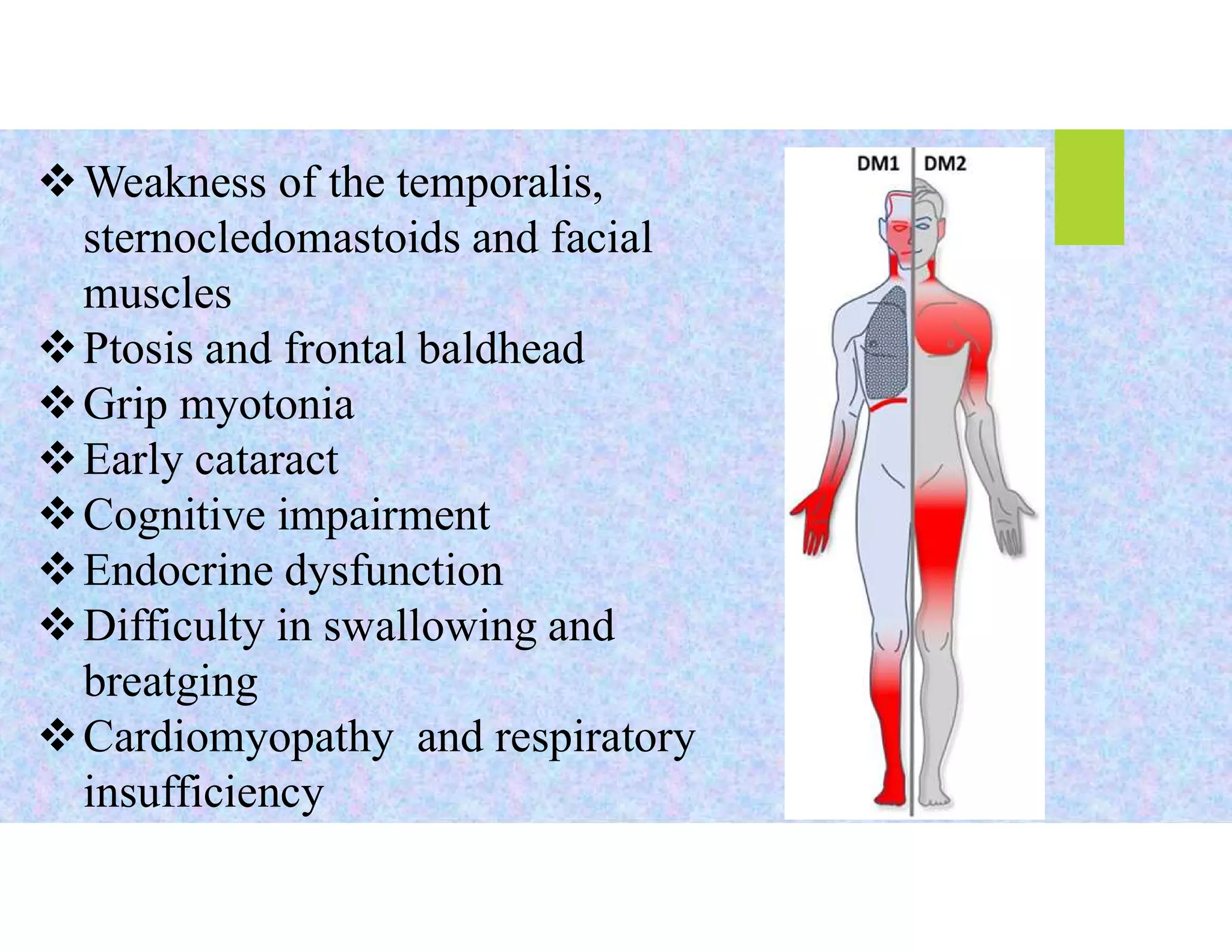 MUSCULAR DYSTROPHY PPT pdf | PDF