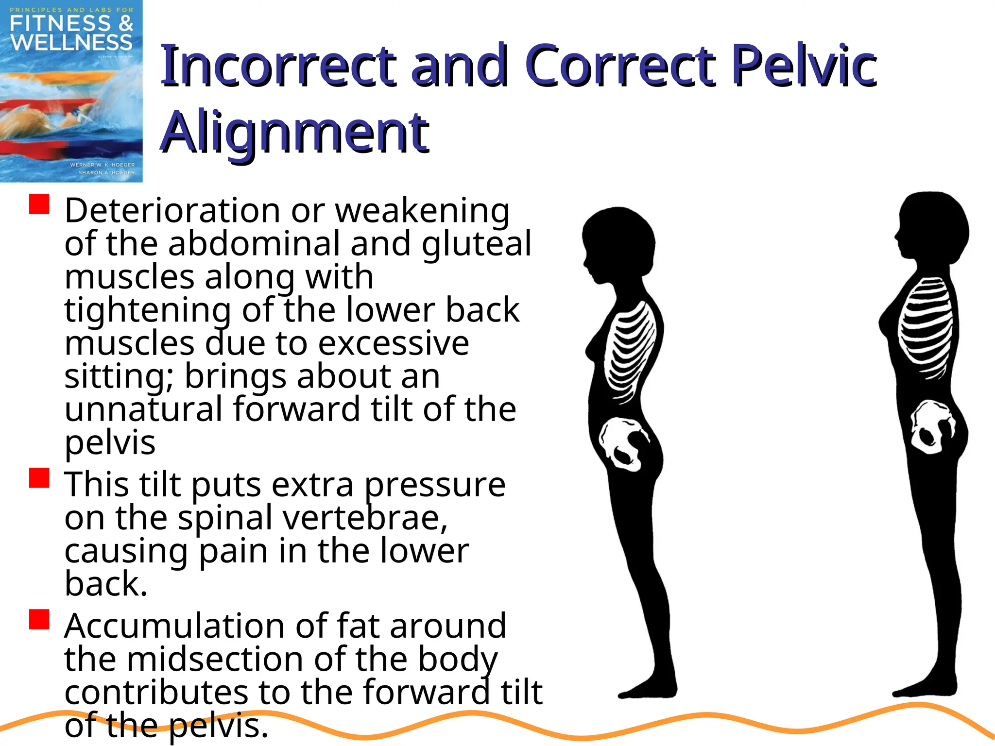 Incorrect and Correct Pelvic
Incorrect and Correct Pelvic
Alignment
Alignment
 Deterioration or weakening
of the abdominal and gluteal
muscles along with
tightening of the lower back
muscles due to excessive
sitting; brings about an
unnatural forward tilt of the
pelvis
 This tilt puts extra pressure
on the spinal vertebrae,
causing pain in the lower
back.
 Accumulation of fat around
the midsection of the body
contributes to the forward tilt
of the pelvis.
 