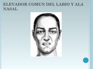 ELEVADOR COMUN DEL LABIO Y ALA
NASAL
 