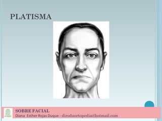 PLATISMA
 