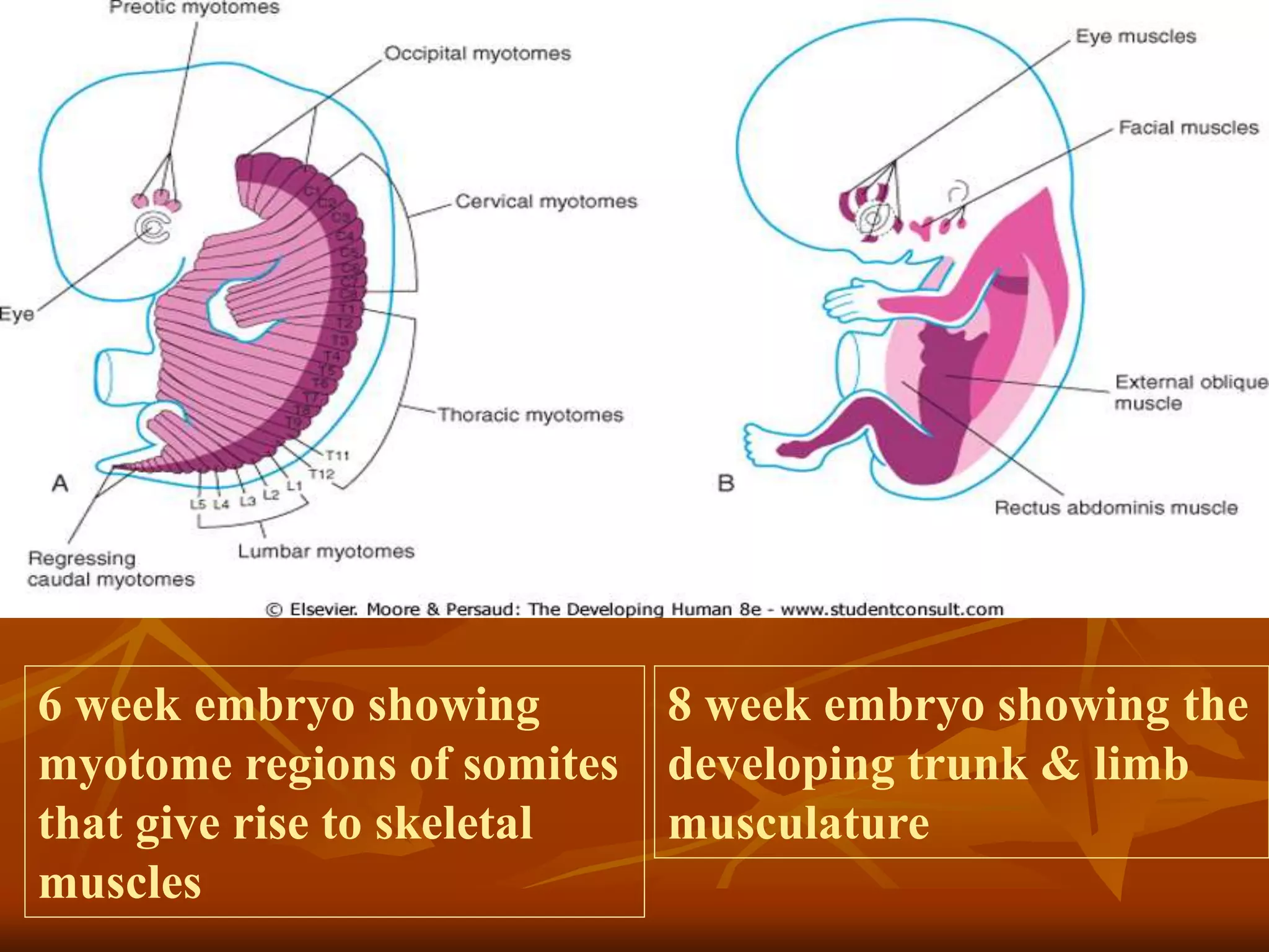 6 week embryo showing
myotome regions of somites
that give rise to skeletal
muscles
8 week embryo showing the
developing trunk & limb
musculature
 
