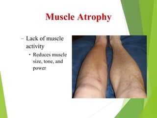 Muscle Atrophy
– Lack of muscle
activity
• Reduces muscle
size, tone, and
power
 