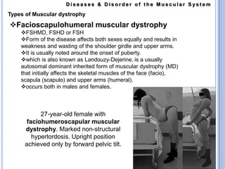 refers to a decrease in size of muscles. Individual muscle fibers decrease in size, and there  is a progressive loss of myofibrils.