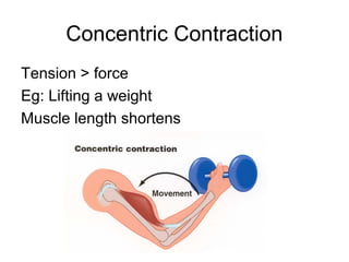 Concentric Contraction
Tension > force
Eg: Lifting a weight
Muscle length shortens
 