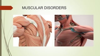 MUSCULAR DISORDERS
 