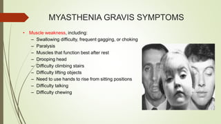 MYASTHENIA GRAVIS SYMPTOMS
• Muscle weakness, including:
– Swallowing difficulty, frequent gagging, or choking
– Paralysis
– Muscles that function best after rest
– Drooping head
– Difficulty climbing stairs
– Difficulty lifting objects
– Need to use hands to rise from sitting positions
– Difficulty talking
– Difficulty chewing
 