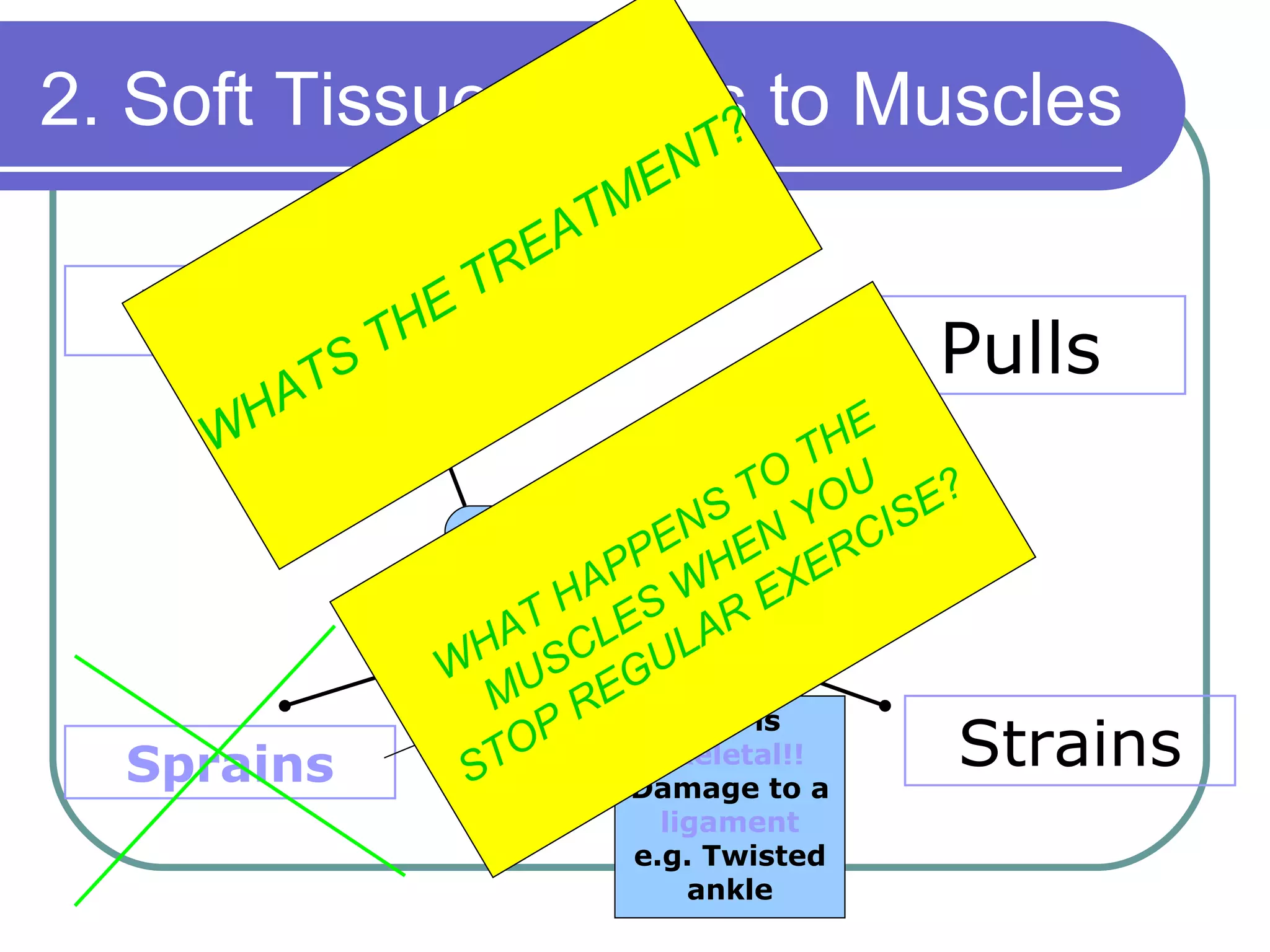 2. Soft Tissue injuries to Muscles ? Pulls Tears Strains Sprains This is  Skeletal!!  Damage to a  ligament  e.g. Twisted ankle WHATS THE TREATMENT? WHAT HAPPENS TO THE  MUSCLES WHEN YOU  STOP REGULAR EXERCISE? 