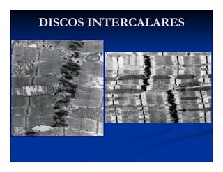 DISCOS INTERCALARESDISCOS INTERCALARES
 