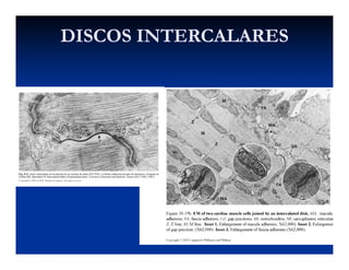 DISCOS INTERCALARESDISCOS INTERCALARES
 