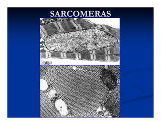 SARCOMERASSARCOMERAS
 