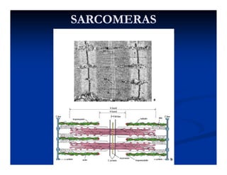 SARCOMERASSARCOMERAS
 