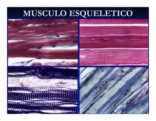 MUSCULO ESQUELETICOMUSCULO ESQUELETICO
 
