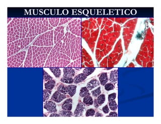 MUSCULO ESQUELETICOMUSCULO ESQUELETICO
 