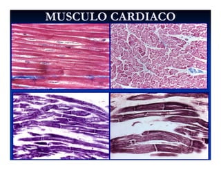 MUSCULO CARDIACOMUSCULO CARDIACO
 