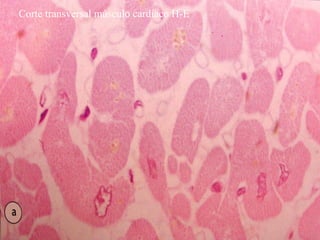 Corte transversal músculo cardíaco H-E
 