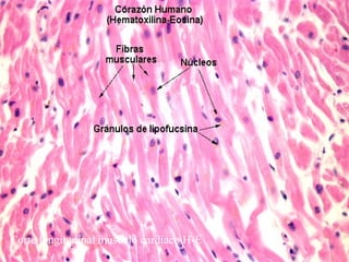 Corte longitudinal músculo cardíaco H-E
 