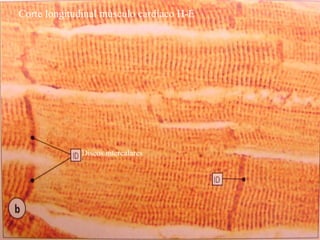 Corte longitudinal músculo cardíaco H-E
Discos intercalares
 
