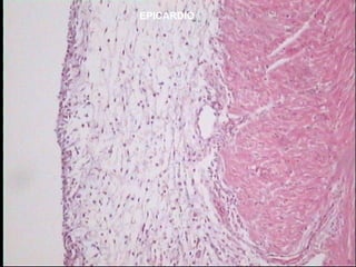EPICARDIO
 
