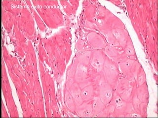 Sistema éxito conductor
 