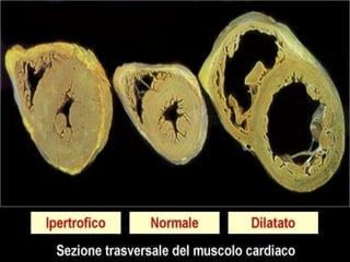 Musculo cardiaco-20091
