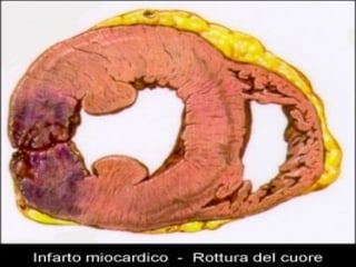 Musculo cardiaco-20091