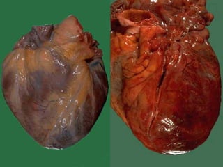 Musculo cardiaco-20091