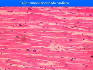 Tejido muscular estriado cardíaco
F
E
 