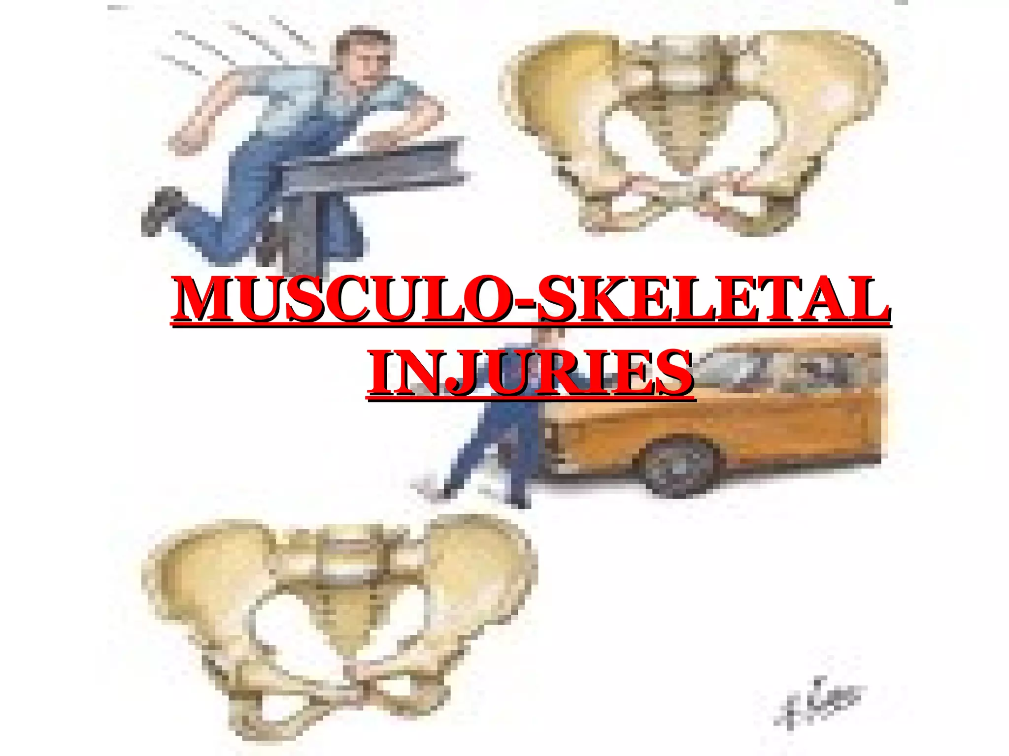 Musculo skeletal injuries | PPT