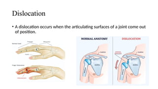 MUSCULO-SKELETAL SYSTEM: Adult Health Nsg.pptx