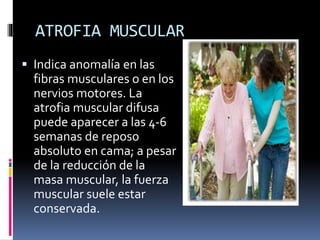 ATROFIA MUSCULAR
 Indica anomalía en las
fibras musculares o en los
nervios motores. La
atrofia muscular difusa
puede aparecer a las 4-6
semanas de reposo
absoluto en cama; a pesar
de la reducción de la
masa muscular, la fuerza
muscular suele estar
conservada.
 