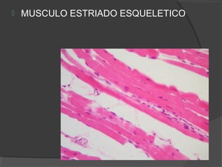    MUSCULO ESTRIADO ESQUELETICO
 