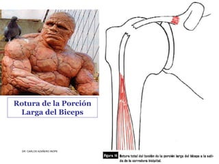 Musculos De La Extremidad Superior