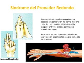  Compuesta por uno o dos ganglios linfáticos