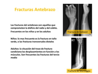  Su único eferente drena en la cadena humeral o raramente en los ganglios del hueco axilar Cadena Interósea Posterior (1%) Se ubica en el tercio superior del antebrazo, en relación con los vasos interóseos posteriores.