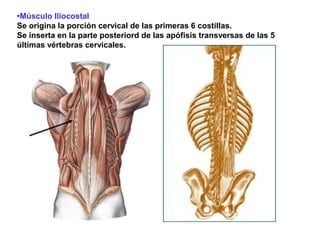 •Músculo Iliocostal
Se origina la porción cervical de las primeras 6 costillas.
Se inserta en la parte posteriord de las apófisis transversas de las 5
últimas vértebras cervicales.
 