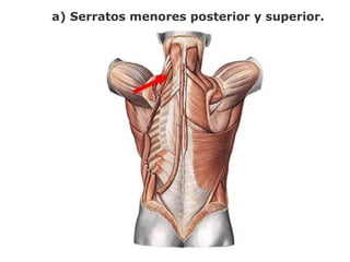 a) Serratos menores posterior y superior.
 