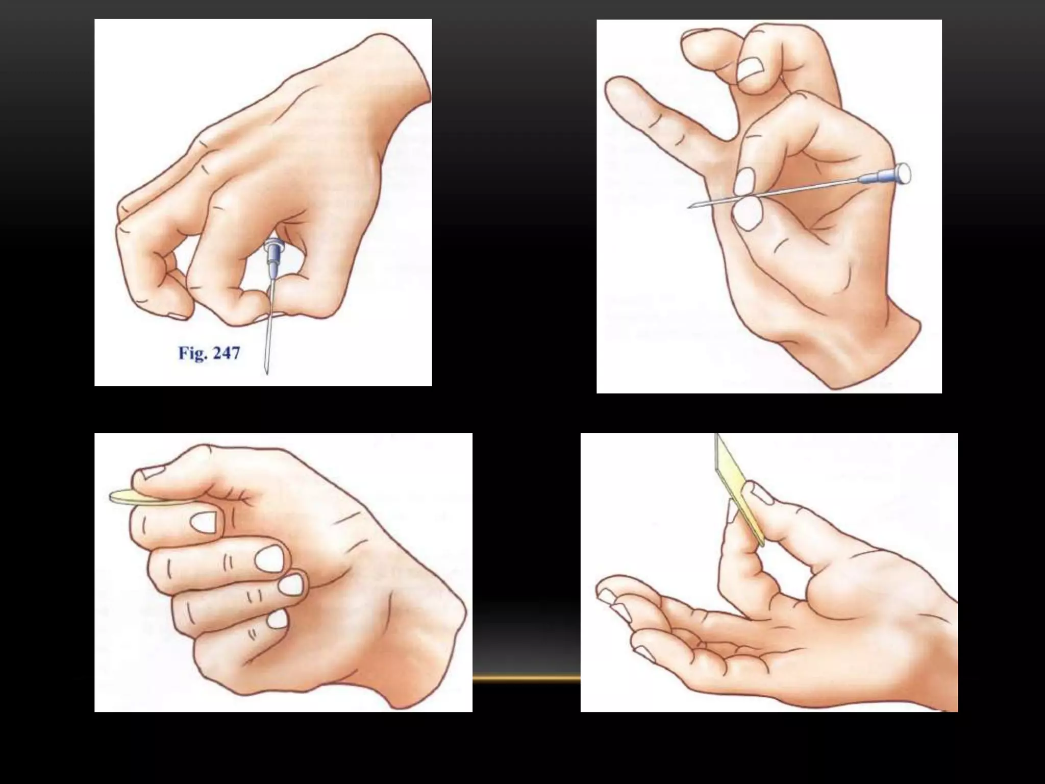 Musculos de la mano | PPTX