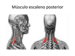 Músculo escaleno posterior