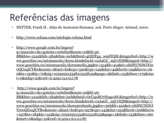 Referências das imagens
• NETTER, Frank H.. Atlas de Anatomia Humana. 2ed. Porto Alegre: Artmed, 2000.
• http://www.coluna.com/miologia-coluna.html
• http://www.google.com.br/imgres?
q=musculo+da+goteira+vertebral&num=10&hl=ptBR&biw=1241&bih=584&tbm=isch&tbnid=gQEfFg4_wmlTQM:&imgrefurl=http://w
ww.geocities.ws/miomusculo/dorso.htm&docid=c2AaGC_mjt7JQM&imgurl=http://
www.geocities.ws/miomusculo/dorsomedia.jpg&w=554&h=414&ei=ohSNUNiWJYiw
0QGxqICYBw&zoom=1&iact=hc&vpx=590&vpy=149&dur=42&hovh=194&hovw=26
0&tx=150&ty=70&sig=105929313348103258159&page=1&tbnh=133&tbnw=179&star
t=0&ndsp=21&ved=1t:429,r:3,s:0,i:78
•

http://www.google.com.br/imgres?
q=musculo+da+goteira+vertebral&num=10&hl=ptBR&biw=1241&bih=584&tbm=isch&tbnid=OrUquBO7HngczM:&imgrefurl=http://w
ww.geocities.ws/miomusculo/dorso.htm&docid=c2AaGC_mjt7JQM&imgurl=http://
www.geocities.ws/miomusculo/dorsoprofundo.jpg&w=506&h=422&ei=ohSNUNiWJ
Yiw0QGxqICYBw&zoom=1&iact=hc&vpx=957&vpy=143&dur=223&hovh=206&hovw
=247&tx=184&ty=143&sig=105929313348103258159&page=1&tbnh=133&tbnw=160
&start=0&ndsp=21&ved=1t:429,r:6,s:0,i:87

 