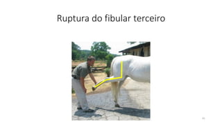 Ruptura do fibular terceiro
41
 