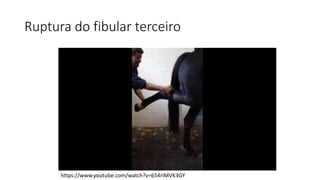 Ruptura do fibular terceiro
https://www.youtube.com/watch?v=654riMVK3GY
 