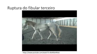 Ruptura do fibular terceiro
https://www.youtube.com/watch?v=8zKK6e44iok
 